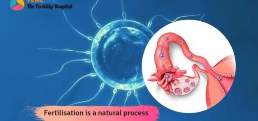 IVF treatment