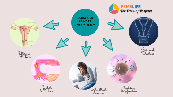 Femelife Infertility