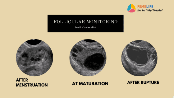 follicle development