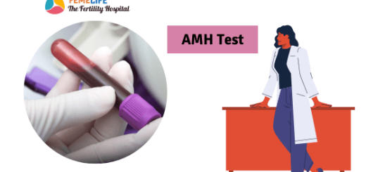 AMH test