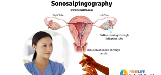 sonosalpingography