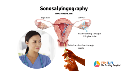 sonosalpingography