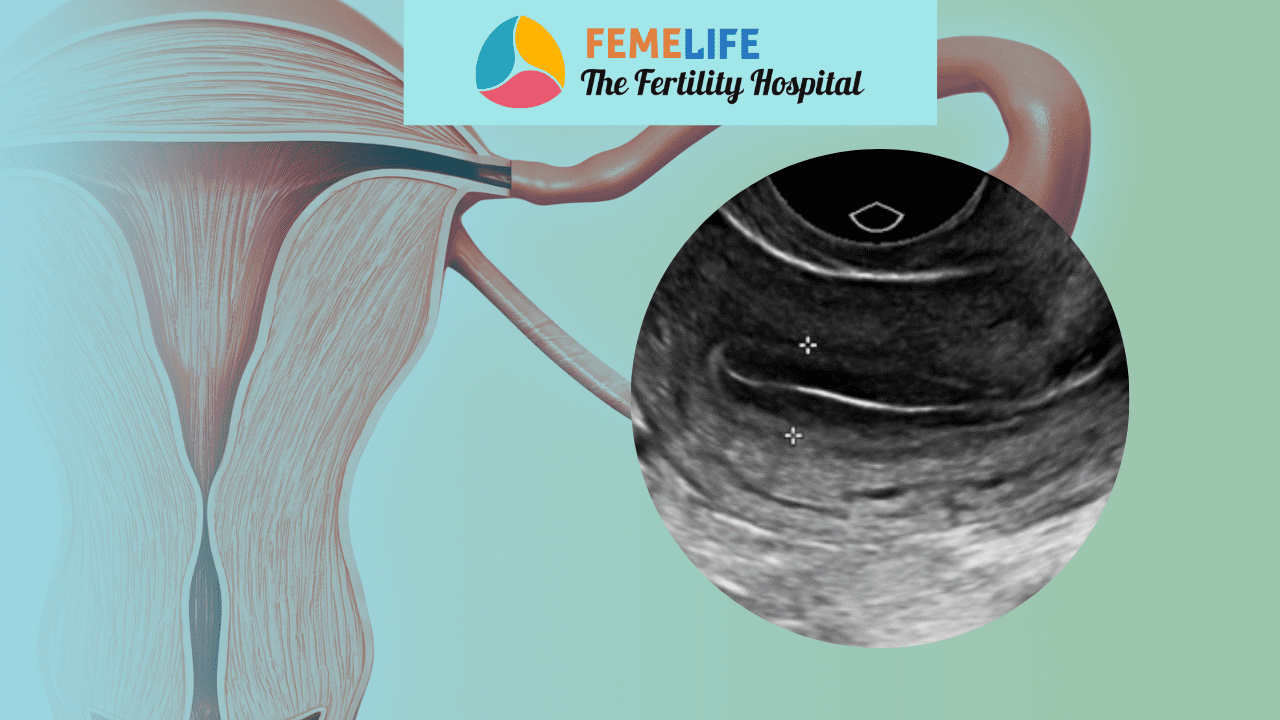 Endometrium thickness