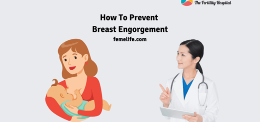 Breast engorgement