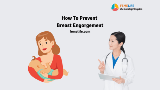 Breast engorgement