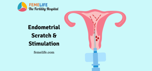 Endometrial scratch