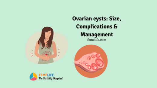 Ovarian cysts