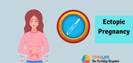 Ectopic pregnancy causes