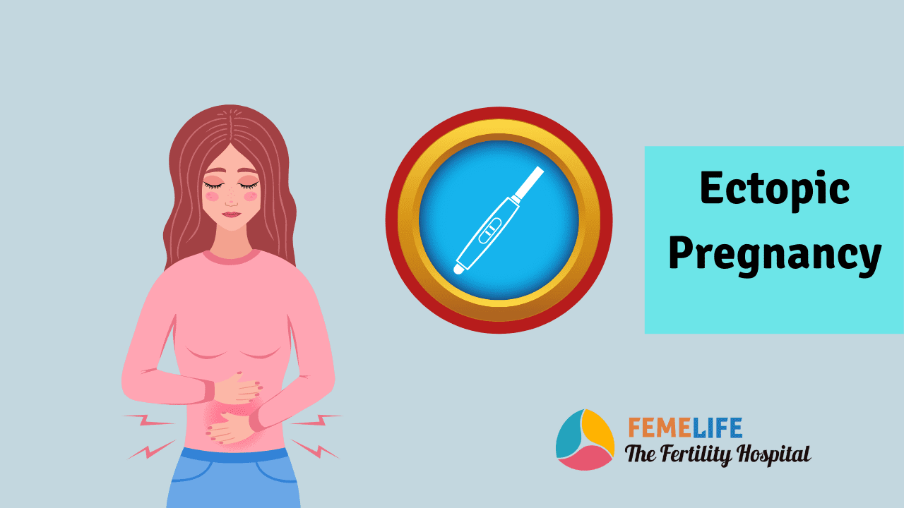 Ectopic pregnancy causes