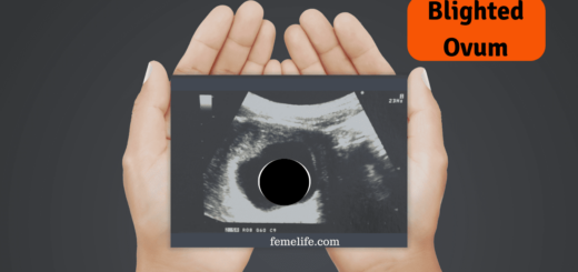 Blighted Ovum