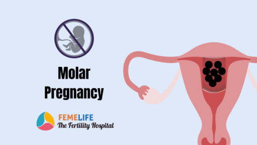 Molar Pregnancy