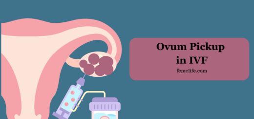 Ovum Pickup in IVF