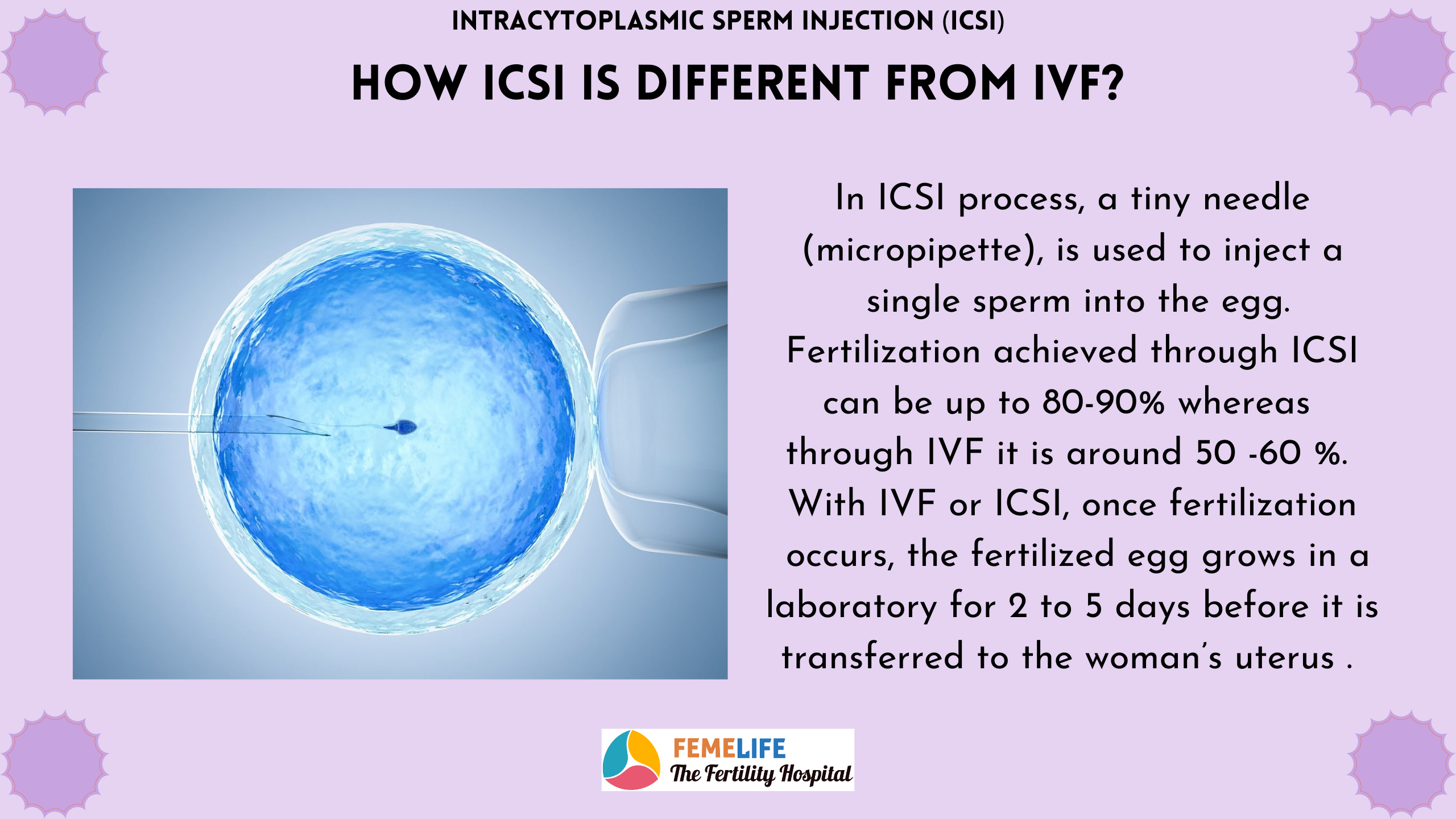 IVF Process Step by Step